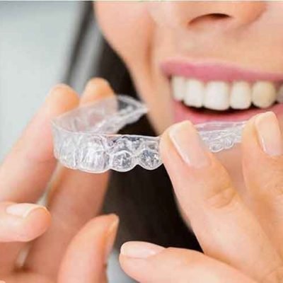 No More Crooked Teeth: Let that Smile Shine