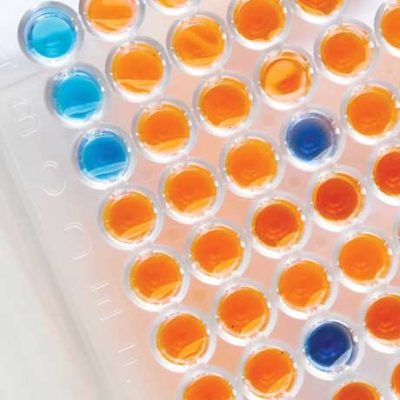 ELISA-Kit-Procedure-–-What-Is-It-and-What-Are-Its-Applications