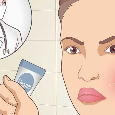 How-to-treat-acne-naturally