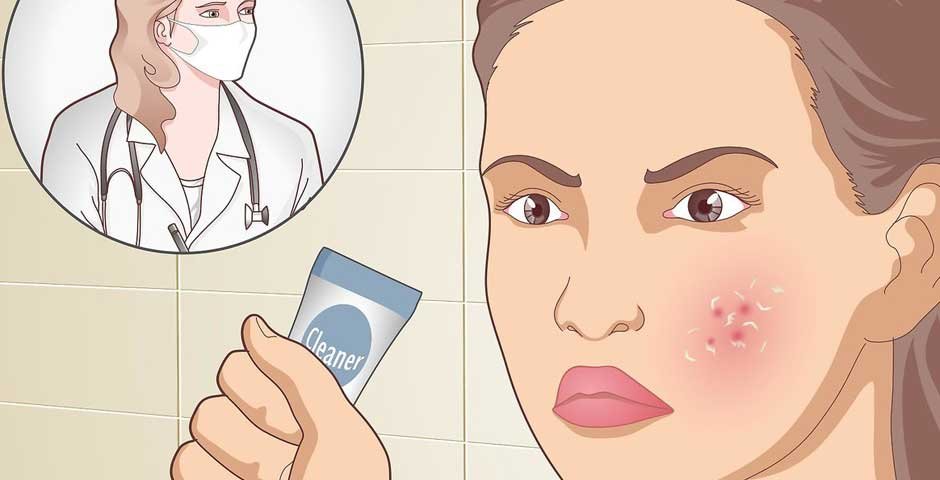 How-to-treat-acne-naturally