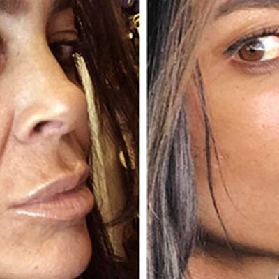Effective Strategies to Prevent the Signs of Aging