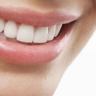 Perfect-Smile-and-Maintain-Your-Pearly-Whites