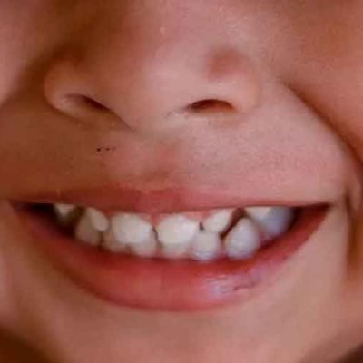 Understanding-the-Benefits-of-Baby-Teeth