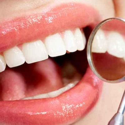Unraveling-the-Need-for-Dental-Care