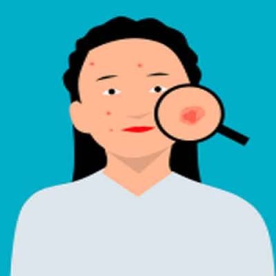 How-to-Diminish-Skin-Blemishes