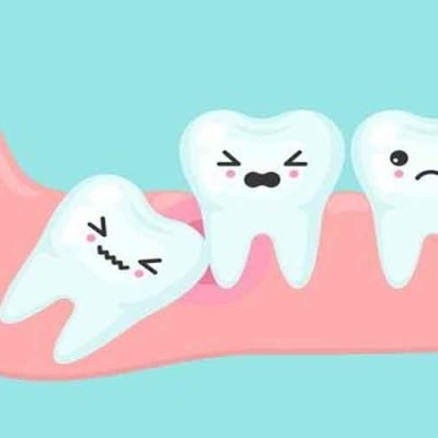 Expert Tips for Mouth Maintenance