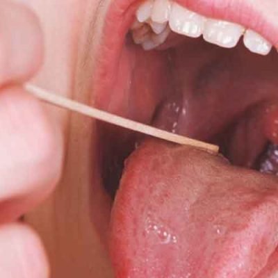 Tired-of-Recurrent-Tonsillitis