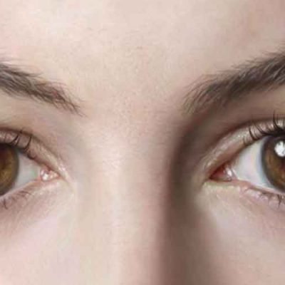 What-Are-The-Different-Types-Of-Eyelids