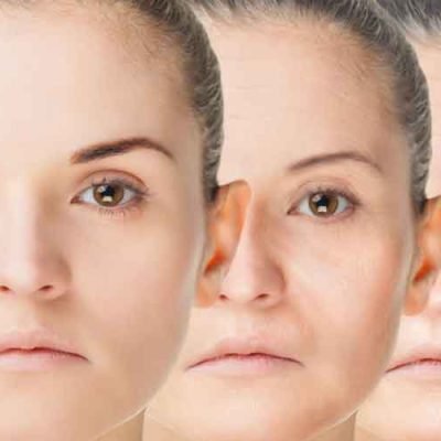 Exploring The Anti-Aging Benefits Of IV Infusions in the USA