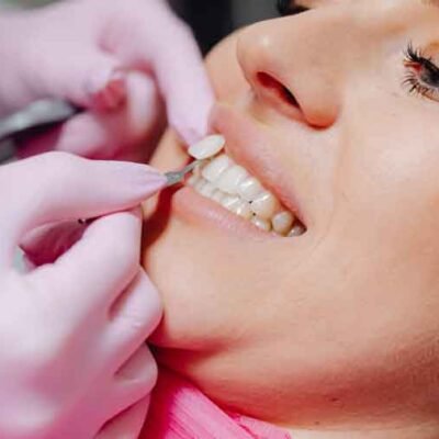 professional-cosmetic-dentistry-in-Denver