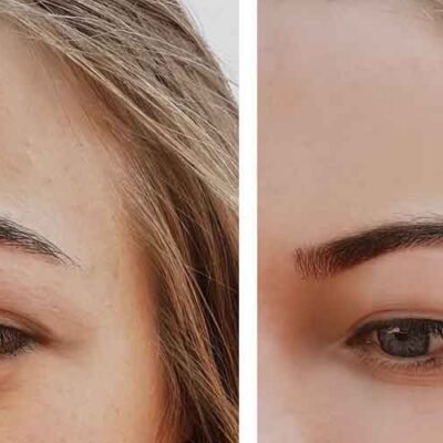The-many-benefits-of-eye-filler-treatment