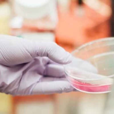 Evaluating-Value-Understanding-the-Cost-Benefit-of-Stem-Cell-Treatments